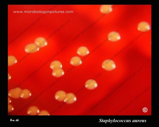 s.aureus yellow pigment